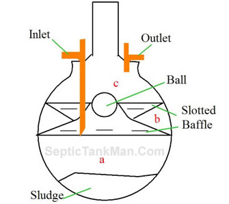 bottle septic tank systems